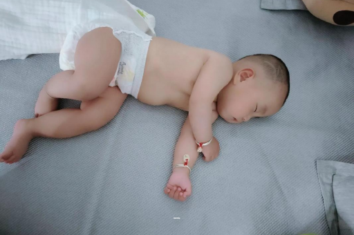 靖边宝宝脸上有白色斑块